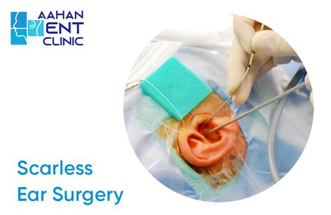 Scarless Ear Surgery Aahan Ent Clinic Drajay Doiphode