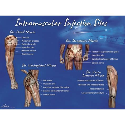 Lifeform Intramuscular Injection Sites Poster