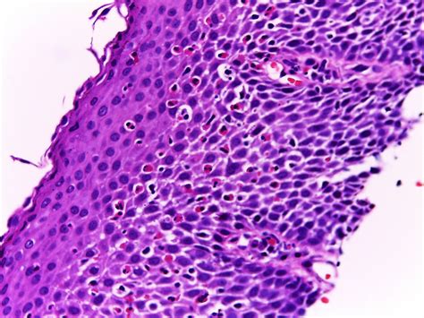 Gastrointestinal And Liver Histology Pathology Atlas Esophagus