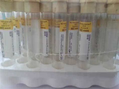 Vacutainer Acd Solution A Ppt Prf Glass Prp Tube Ml Set Of
