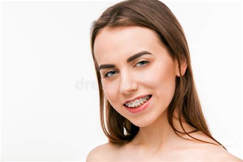 Beautiful Young Woman With Teeth Braces Stock Image Image Of Beautiful Human 88569635
