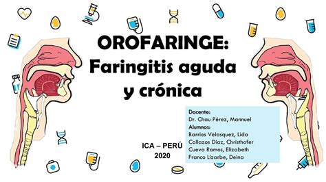 Faringitis Aguda Cronica F Udocz