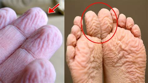 why does your skin fingers hands and feet wrinkle or get pruney in water the reason youtube
