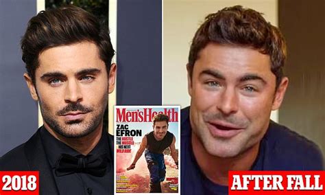 zac efron finally reveals what caused his 2021 face transformation after plastic surgery rumors