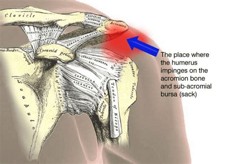 Shoulder Pain After Sleeping And What You Can Do About It
