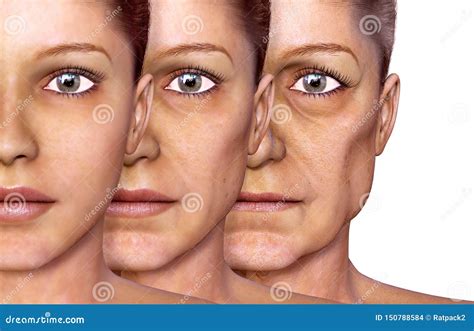 Aging Of A Woman Facial Skin Stock Illustration Illustration Of