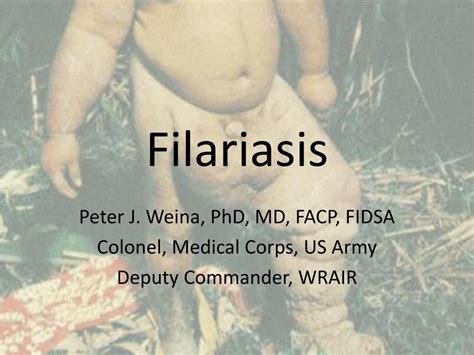 Ppt Filariasis Powerpoint Presentation Free Download Id2282669
