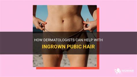 How Dermatologists Can Help With Ingrown Pubic Hair ShunHair