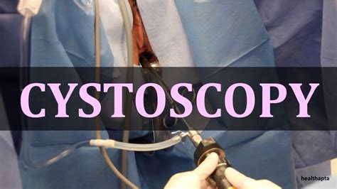 Cystoscopy Youtube