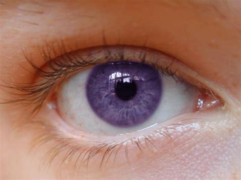6 Fast Ways To Lighten Your Eye Color Naturally