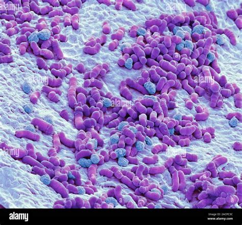 Athletes Foot Fungus Coloured Scanning Electron Micrograph Sem Of
