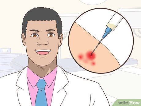 Ways To Get Rid Of Acne Cysts Fast Wikihow