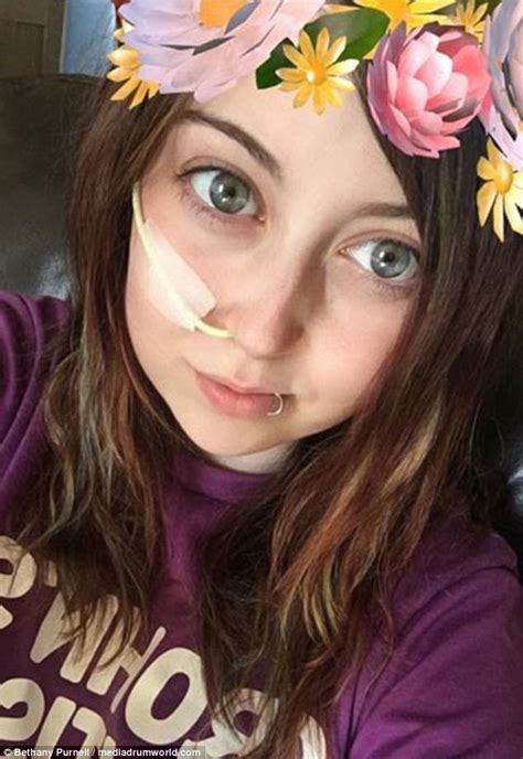 Crohns Sufferer Shows Off Her Ileostomy Bag Daily Mail Online