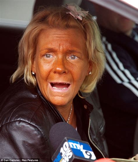 Tanning Mom Patricia Krentcil Out Of Hospital And Back In Rehab After Suffering A Seizure