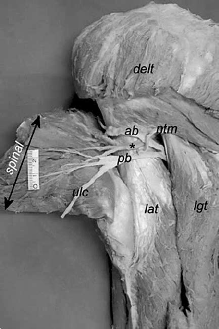 Axillary Nerve In Quadrangular Space — Posterior View Inner Surface Of