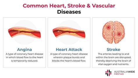 Heart Stroke And Vascular Diseases Statistics