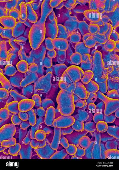 Coloured Scanning Electron Micrograph Sem Of Microbacterium