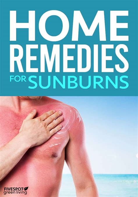 The Best Home Remedies For Sunburn Relief Five Spot Green Living