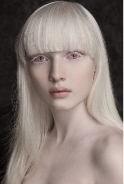 Meet Nastya Zhidkova The Most Beautiful Albino Girl In The World Photos Gistmania