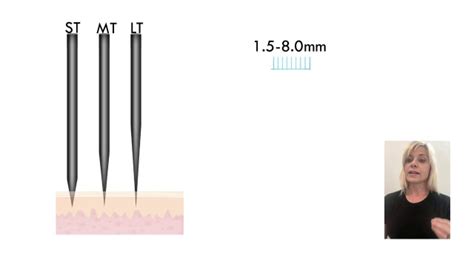 Tattoo Needle Size Chart Full Guide 10masters