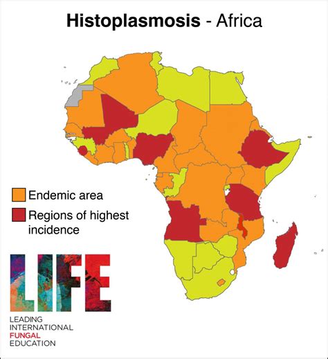 Disseminated Histoplasmosis Life Worldwide