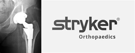 Stryker Lfit Hip Device Lawsuit The Class Action News