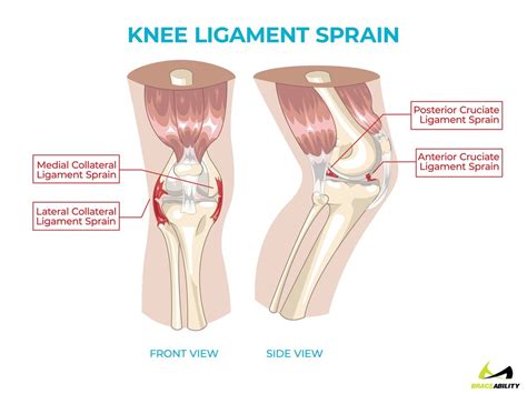 These injuries can be to muscles, tendons, ligaments, bones or joints. Left Leg Ligaments : The knee: Anatomy, injuries ...