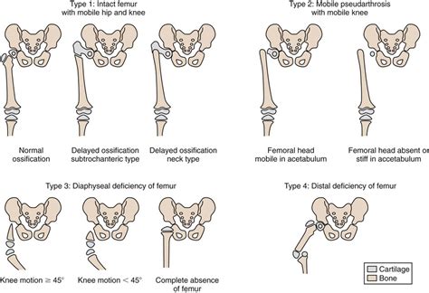 The Pediatric And Adolescent Hip Musculoskeletal Key