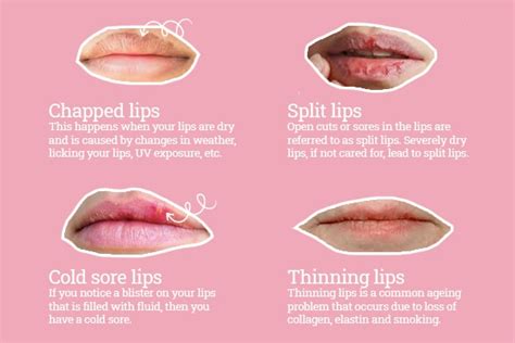 Supple Lips Meaning