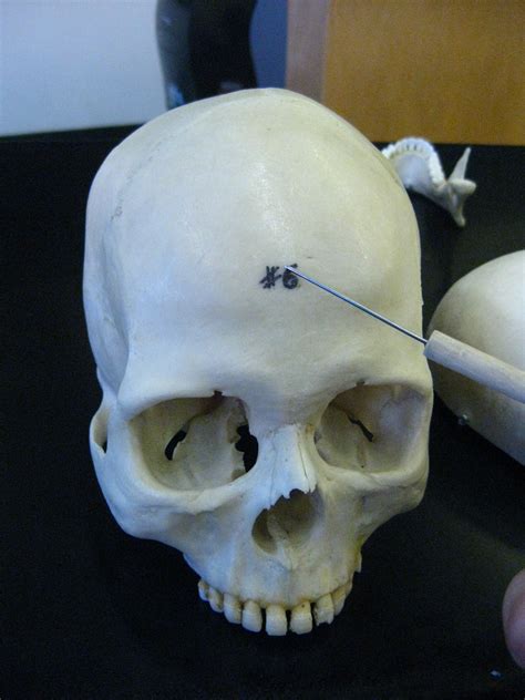 Boned: Human Skull - frontal bone (calvarial bone # 1)