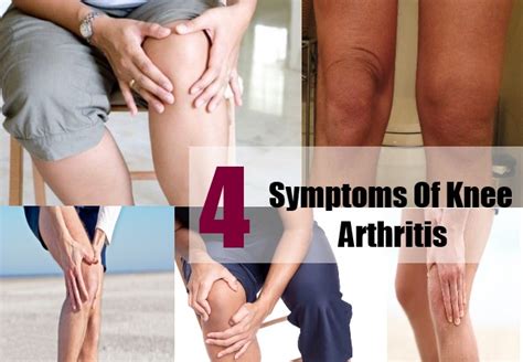 Top 4 Symptoms Of Knee Arthritis Happy Hospital