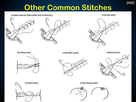 Surgical Sutures And Suturing Techniques