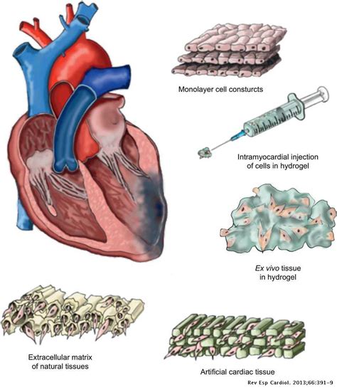 Cardiac Tissue Engineering And The Bioartificial Heart Revista
