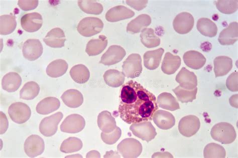 Eosinophil Cell Stock Image Image Of Basophil Eosinophil 101184465
