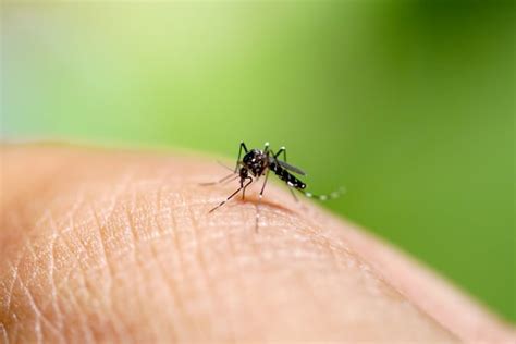 5 Simple Ways To Treat Mosquito Bites