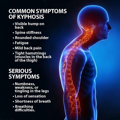 Kyphosis Symptoms Treatment Florida Orthopaedic Institute