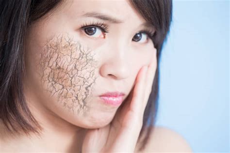 Best Cracked Skin Stock Photos Pictures And Royalty Free Images Istock