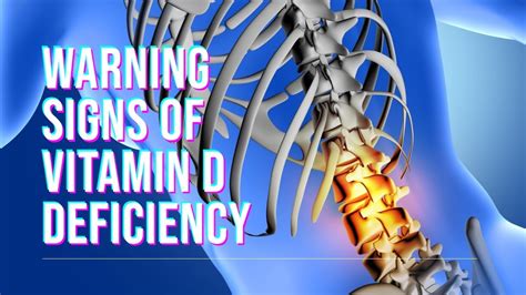 10 Signs Of Vitamin D Deficiency Youtube