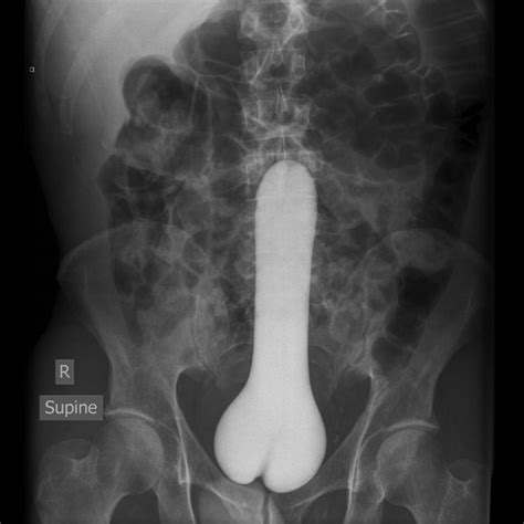 Funny X Ray Xxgasm