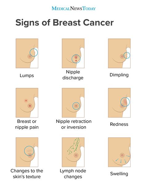 Additionally, when visiting a medical professional you may want to consider the following specific. Breast cancer symptoms: Early signs, pictures, and more