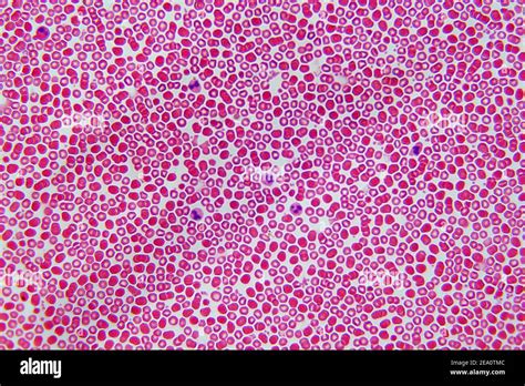Human Blood Smear Light Micrograph Hi Res Stock Photography And Images