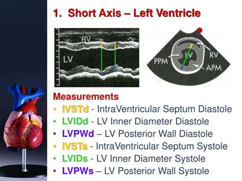 Ppt Basic Echocardiography Powerpoint Presentation Free Download