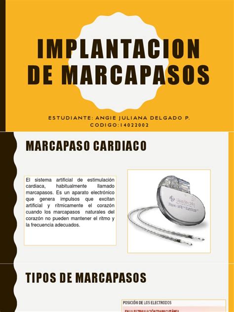 Implantacion De Marcapasos Pdf Marcapasos Cardíacos Artificiales