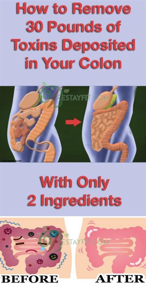 How To Remove 30 Pounds Of Toxins Deposited In Your Colon With Only 2 Ingredients