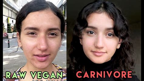 Raw Vegan Diets Are Unhealthy My Experience Youtube