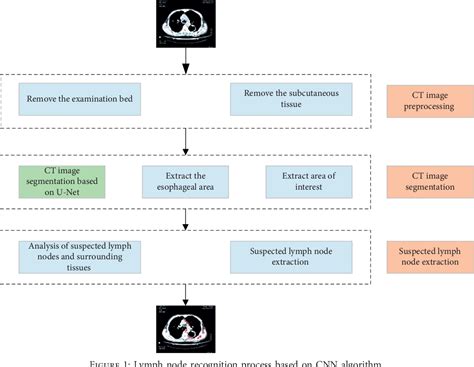 Figure 1 From Deep Learning Based Ct Imaging In Perioperative Period