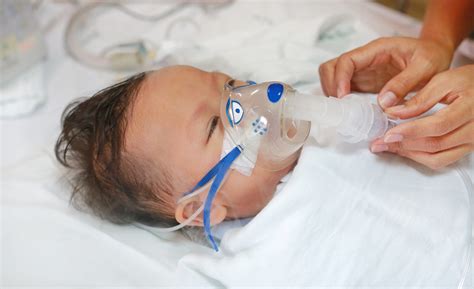 Nebulizers For Babies Chc Solutions