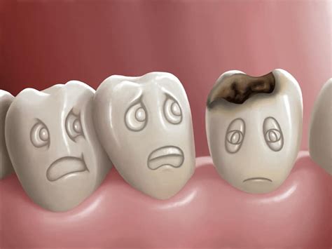 How Sweets Can Harm Your Teeth Avenue Dental Arts