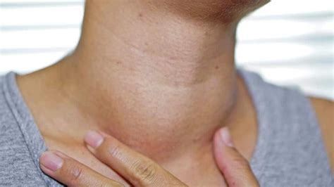 Enlarged Lymph Nodes After Covid 19 Vaccination Could Be Mistaken For