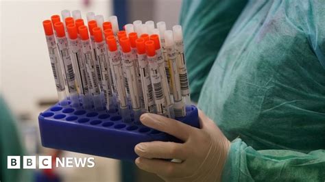 Coronavirus Nhs Staff With Covid 19 Given Wrong Test Results